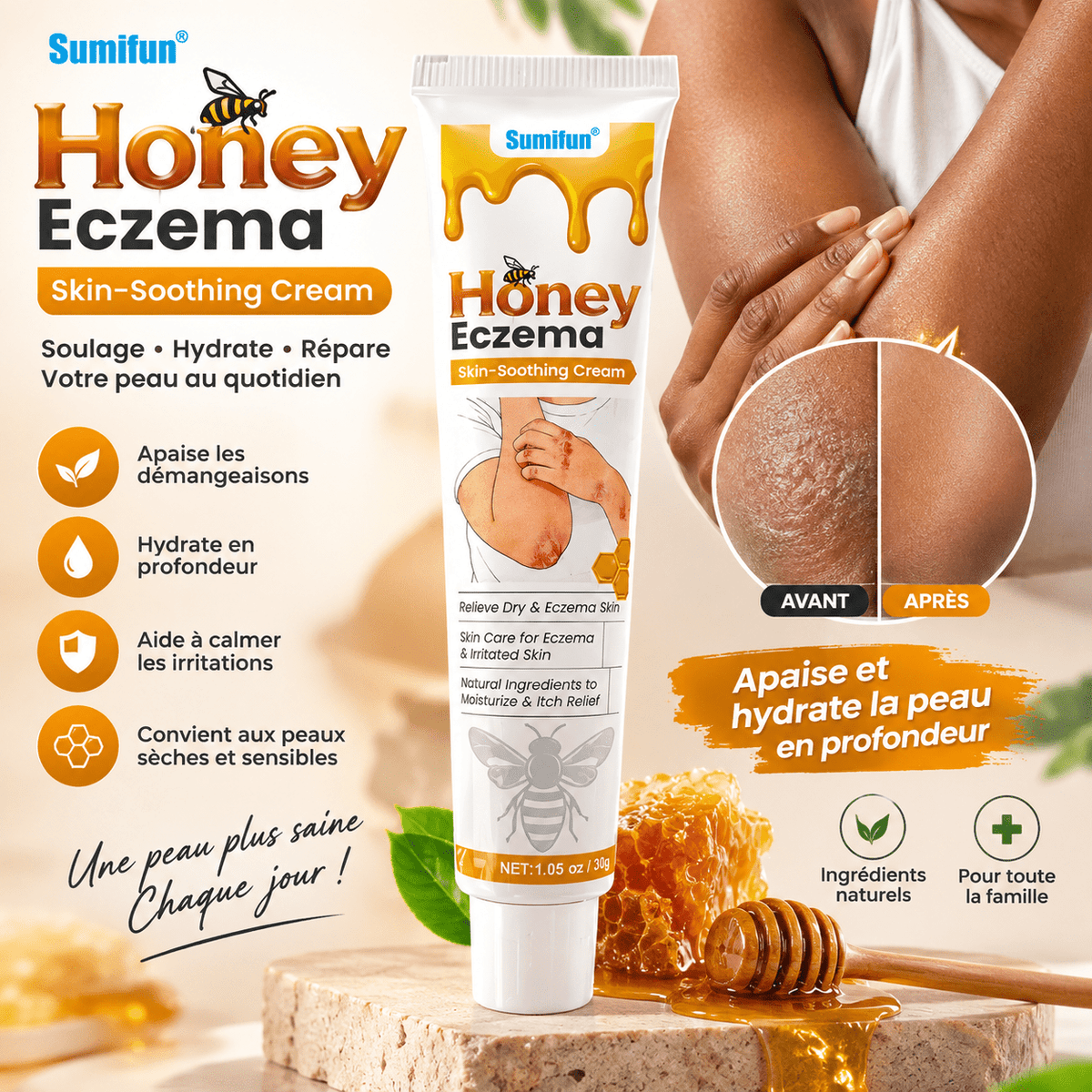 Crème apaisante anti bacterienne pour Peaux Sèches & Irritées - AFRICA STORE