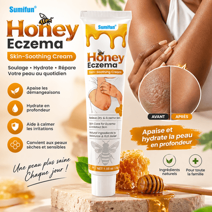 Crème apaisante anti bacterienne pour Peaux Sèches & Irritées - AFRICA STORE