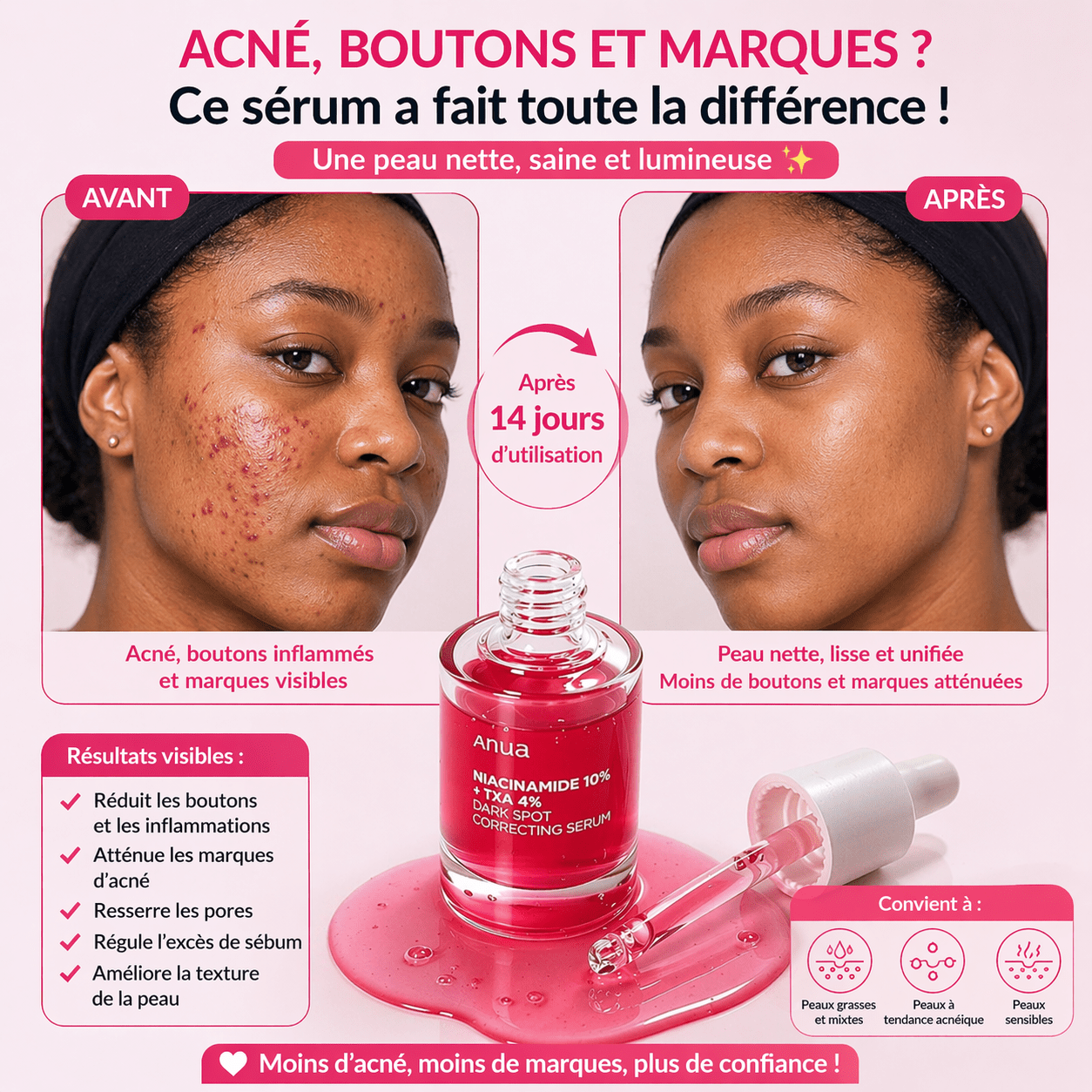 Sérum Niacinamide Anua GB - Anti tâche - Mamies - Rougeur et autres - AFRICA STORE