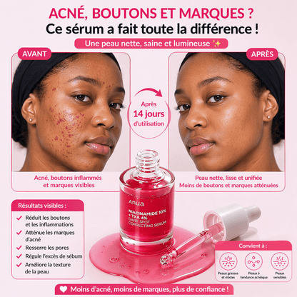 Sérum Niacinamide Anua GB - Anti tâche - Mamies - Rougeur et autres - AFRICA STORE