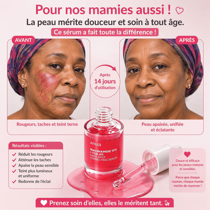 Sérum Niacinamide Anua GB - Anti tâche - Mamies - Rougeur et autres - AFRICA STORE